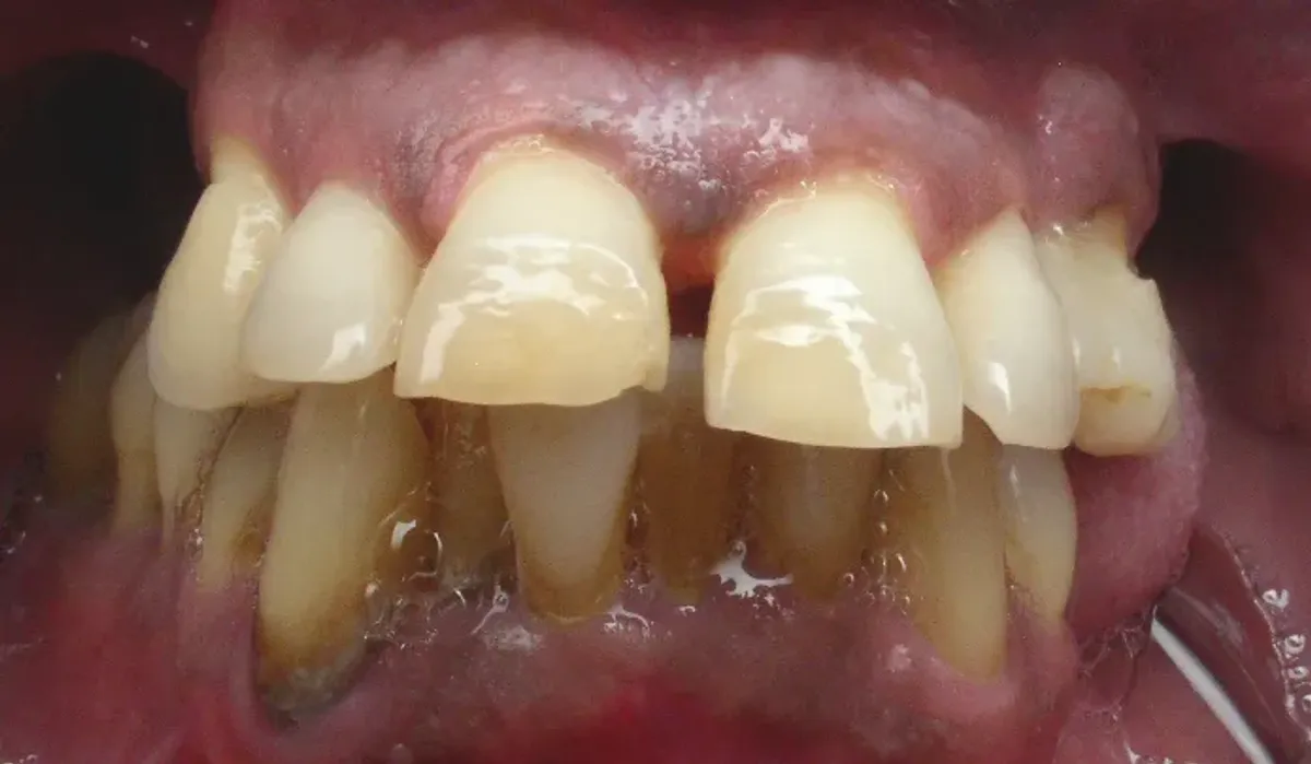 Case 1 — before treatment at Capital Dental Group