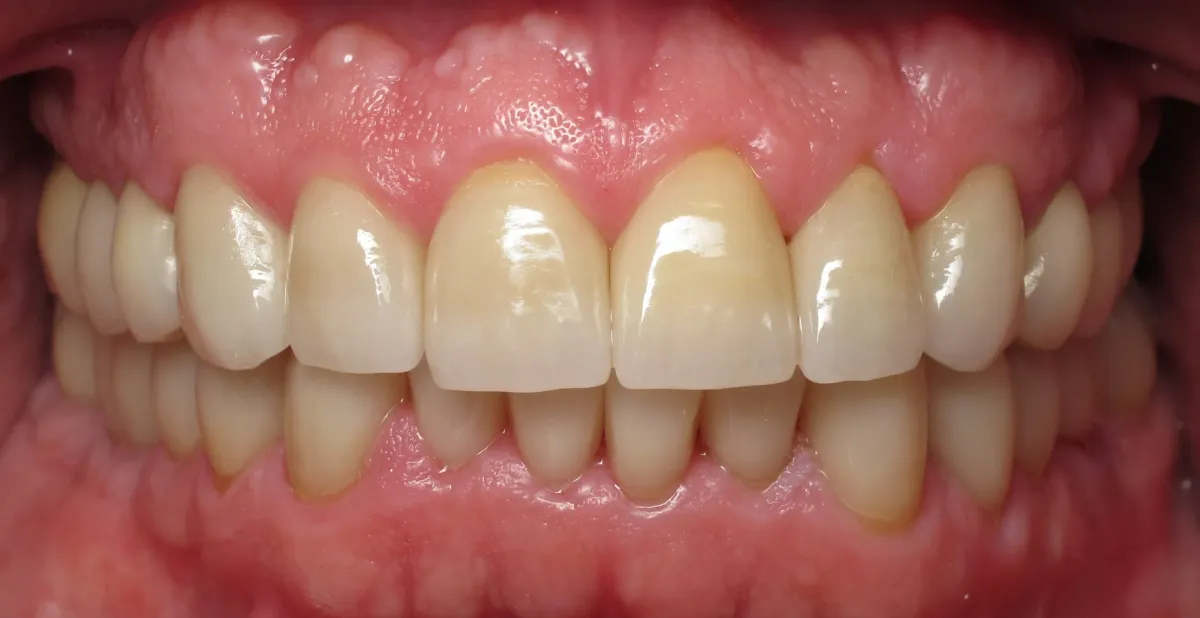 Case 3 — after treatment at Capital Dental Group