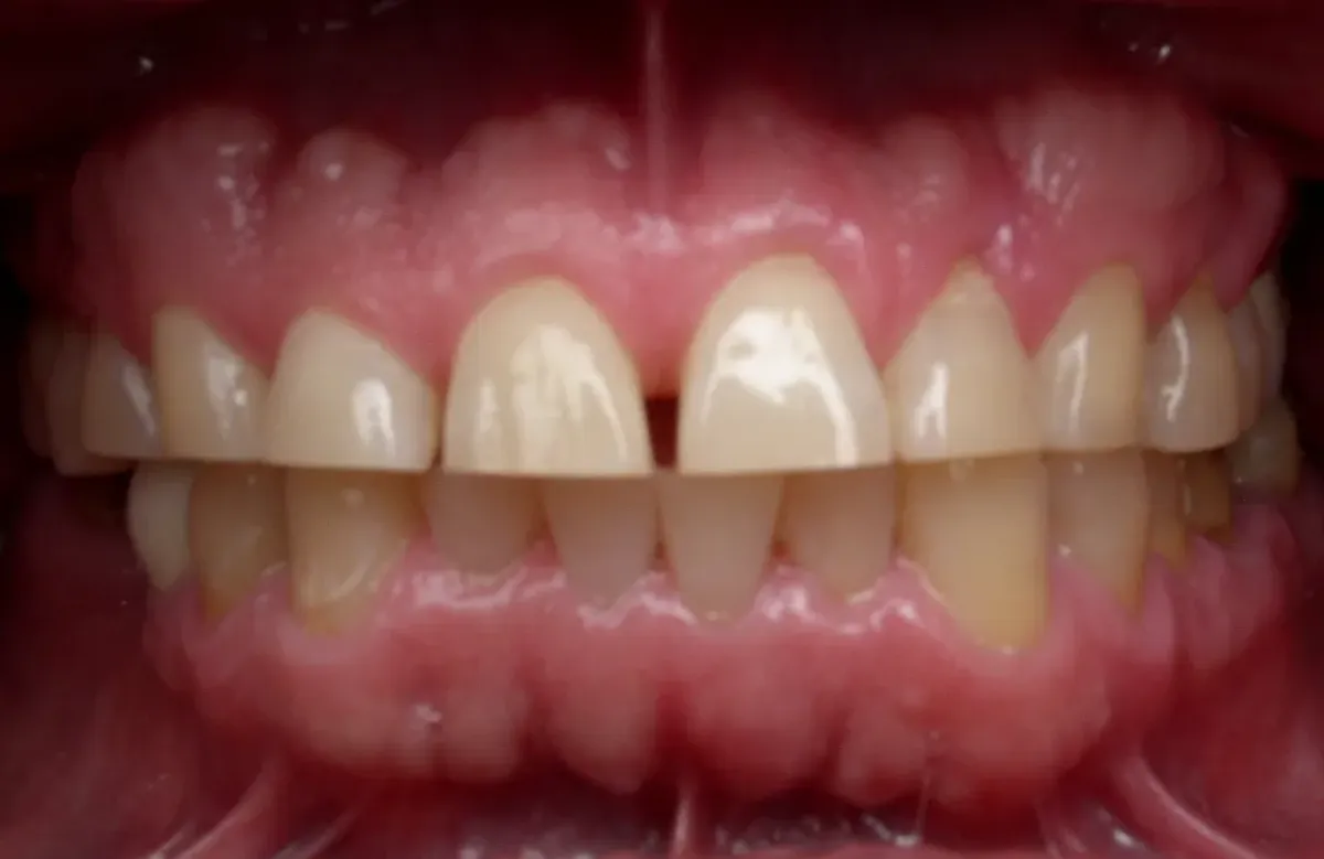 Case 3 — before treatment at Capital Dental Group