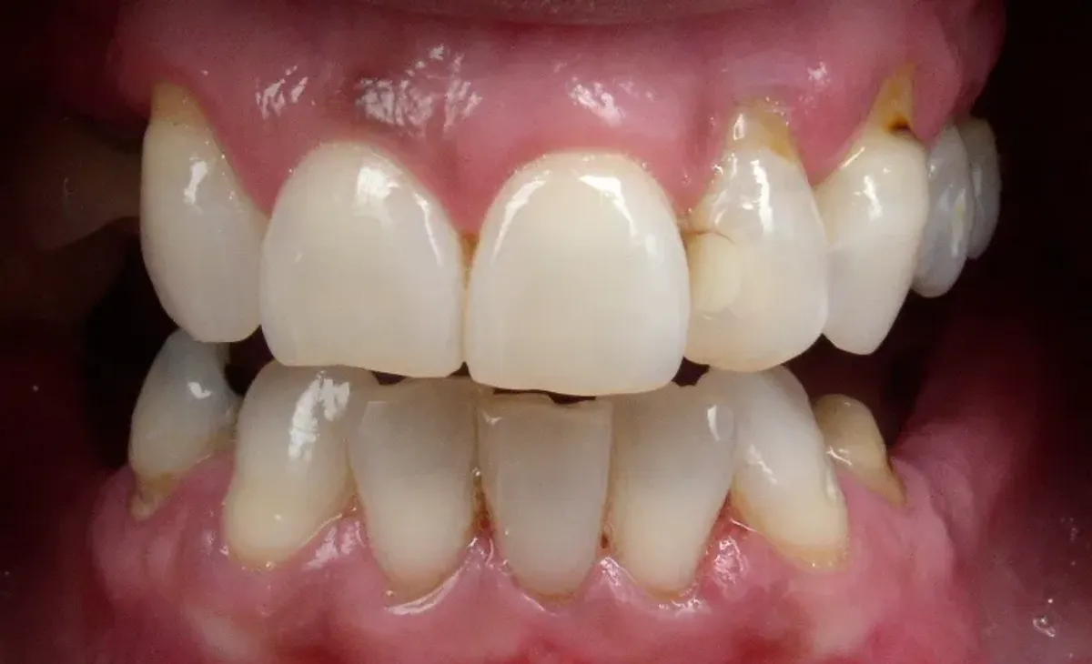 Case 9 — before treatment at Capital Dental Group