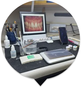 Learn More about the In House Laboratory at Capital Dental Group