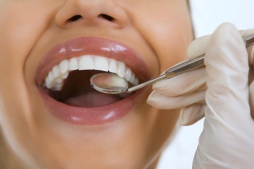 Woman getting dental checkup